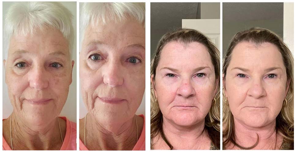 Perbelle CC Cream Before and After